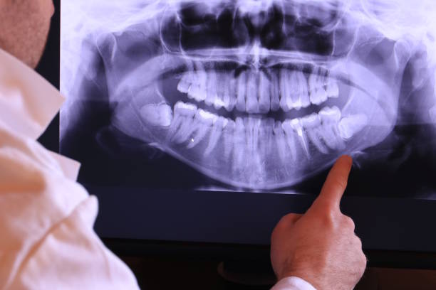 Best Teeth Whitening  in Brownsville, OR