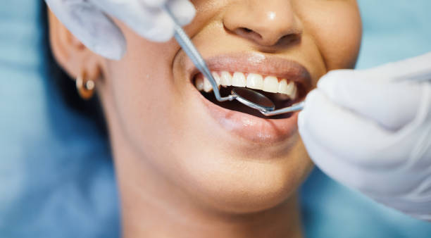 Best Walk-In Dentist Near Me  in Brownsville, OR